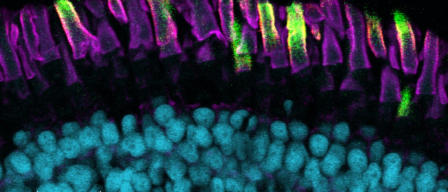 A cross section of eye tissue under a microscope.